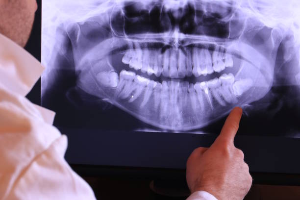 Best Emergency Dental Care for Broken or Chipped Teeth in Coral Hills, MD