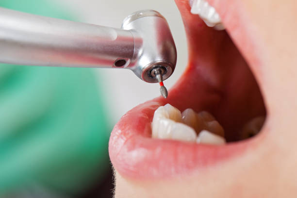 Best Emergency Denture Repair in Coral Hills, MD